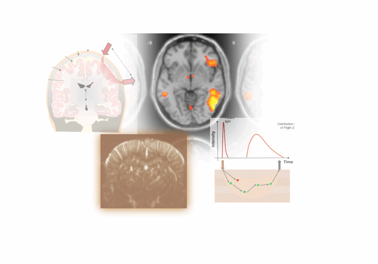 Avancées récentes en imagerie fonctionnelle